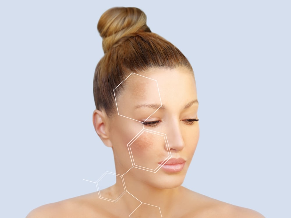 CO2 laser formelasma removal