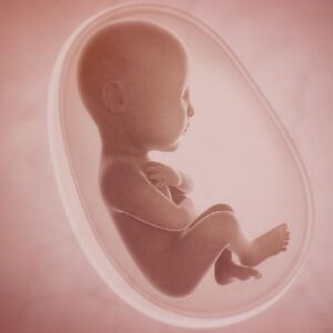 Abortion