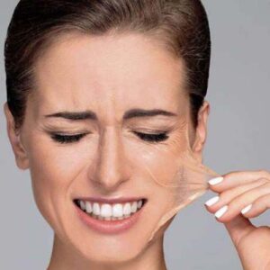 Peeling