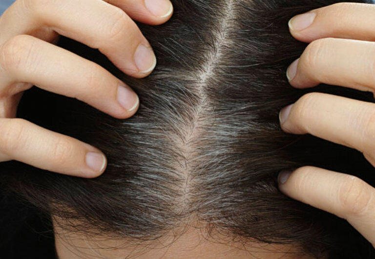 Graying Hair Roots