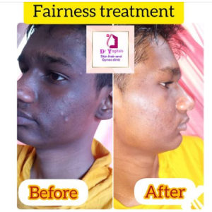 Fairness Treatment