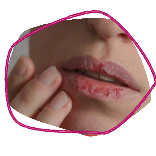 Lip Peeling